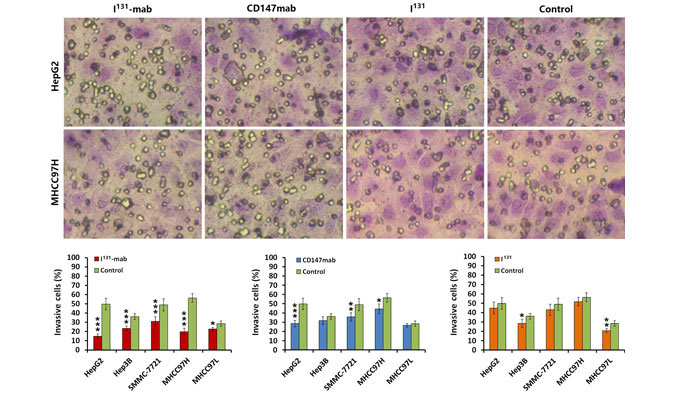 I131 reinforces antitumor activity of metuximab by reversing epithelial–mesenchymal transition via VEGFR‐2 signaling in hepatocellular carcinoma