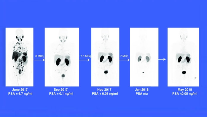 Medical solutions for nuclear medicine